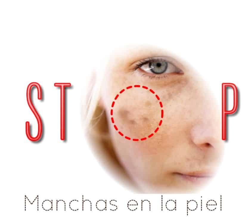 STOP MANCHAS EN LA PIEL